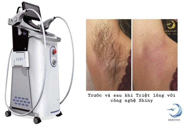 Shiny-oceania-content