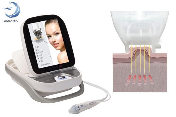 Ulverin-oceania-content