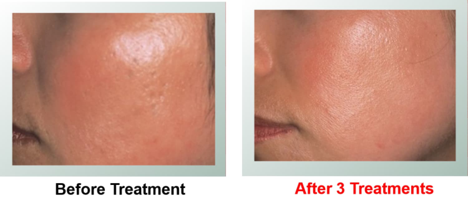 levlanc-lead-light-1